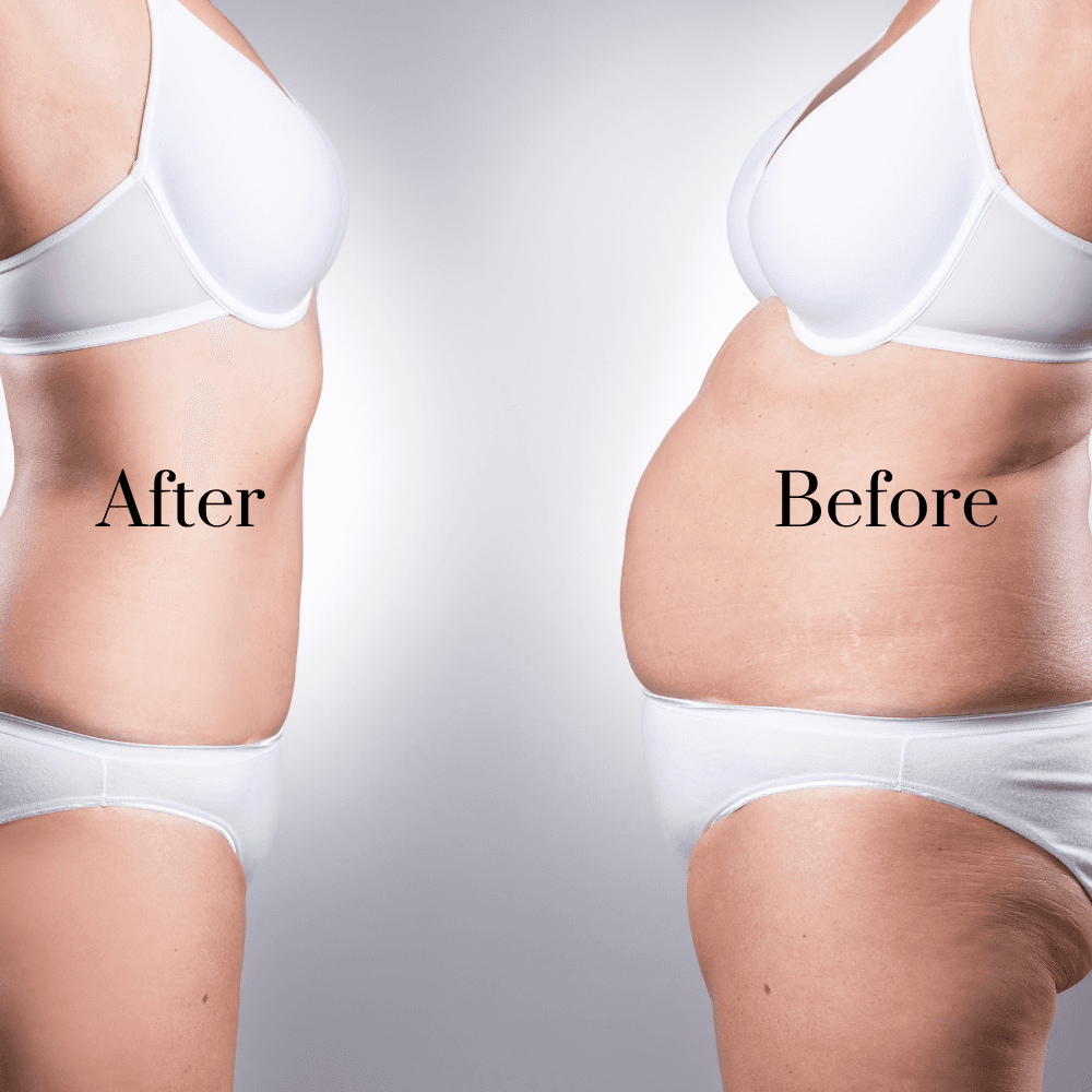 Wow Shape Salendav kehamähis