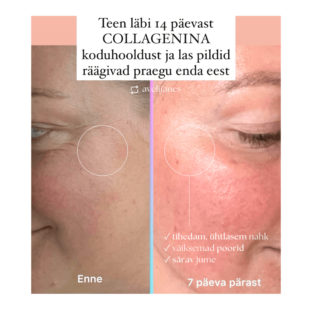 Collagenina 6 kollageeniga tihendav, pinguldav intensiivhooldus tase 2