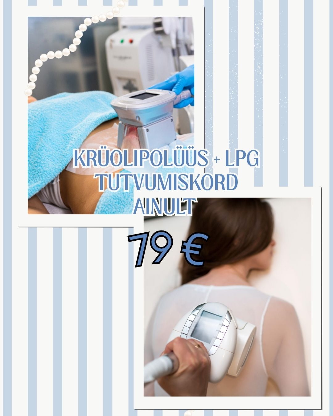 Eripakkumine: Krüolipolüüs + LPG tutvumiskord ainult 79 €